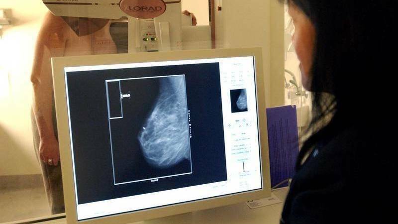 The mobile BreastScreen NSW van in Goulburn is now open, however women in the Southern Highlands will have to wait a little longer until the Bowral clinic reopens. Picture: file.