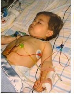 Matt Tremble after a kidney transplant at 17 months old. Photo: Supplied