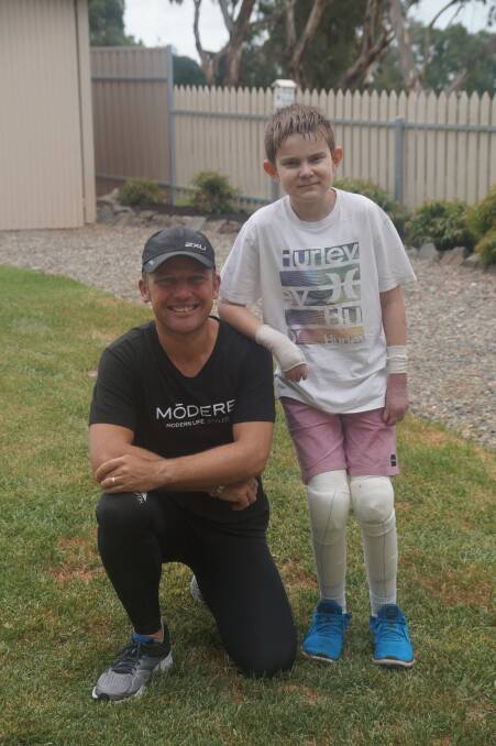 Andrew Biszczak says the Million Dollar Run's ambassador, 'Johnny,' is one of the most incredible children he's ever met. Johnny suffers from Epidermolysis Bullosa. Photo supplied.