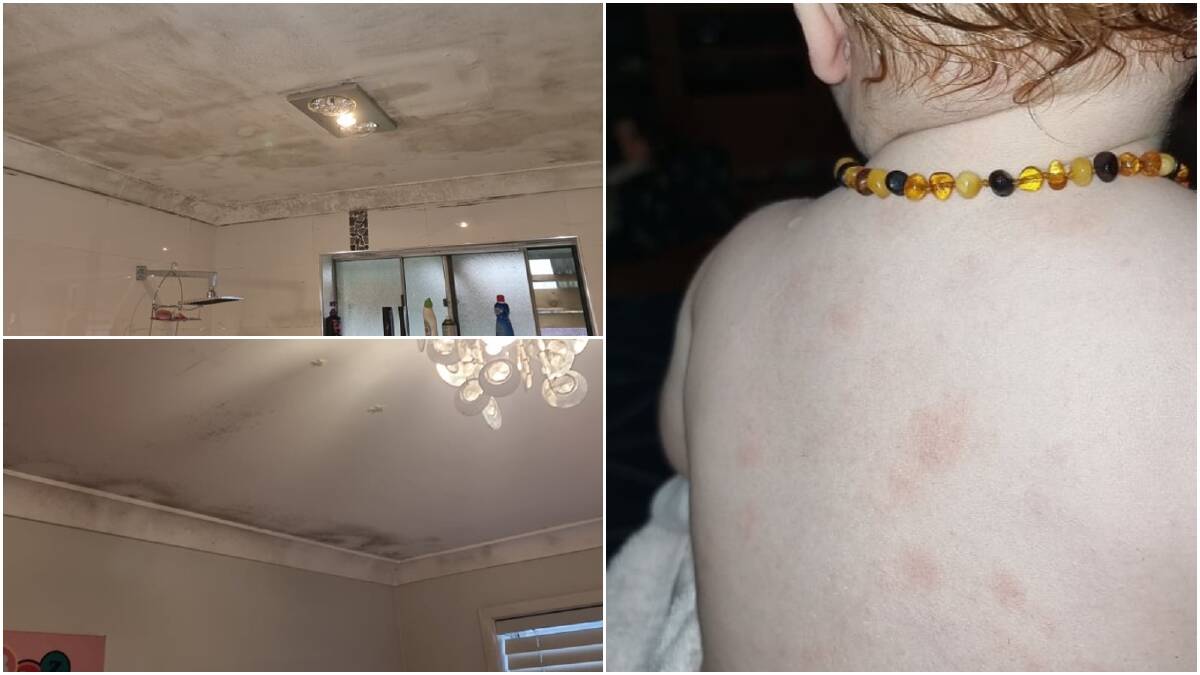 Victims: Albion Park resident Renee Ellington says the health of her family has deteriorated since mould broke out in their rental property - including a daughter taken to hospital with breathing issues and severe eczema appearing all over her baby son (above). Pictures: Supplied 