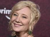 Anne Heche suffered "a significant pulmonary injury" and burns, her representatives say. (AP PHOTO)