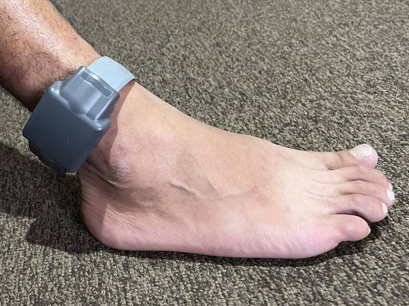 A man took his ankle monitor back to police because he thought it was defective, a court has heard. (Farid Farid/AAP PHOTOS)